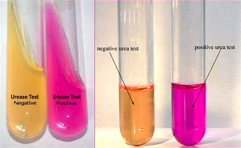 Urea Test.